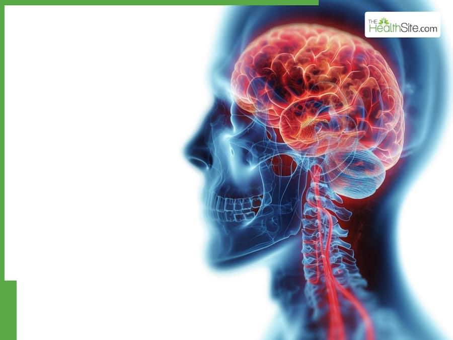 Discapacidades neurológicas: trastornos comunes y tratamiento